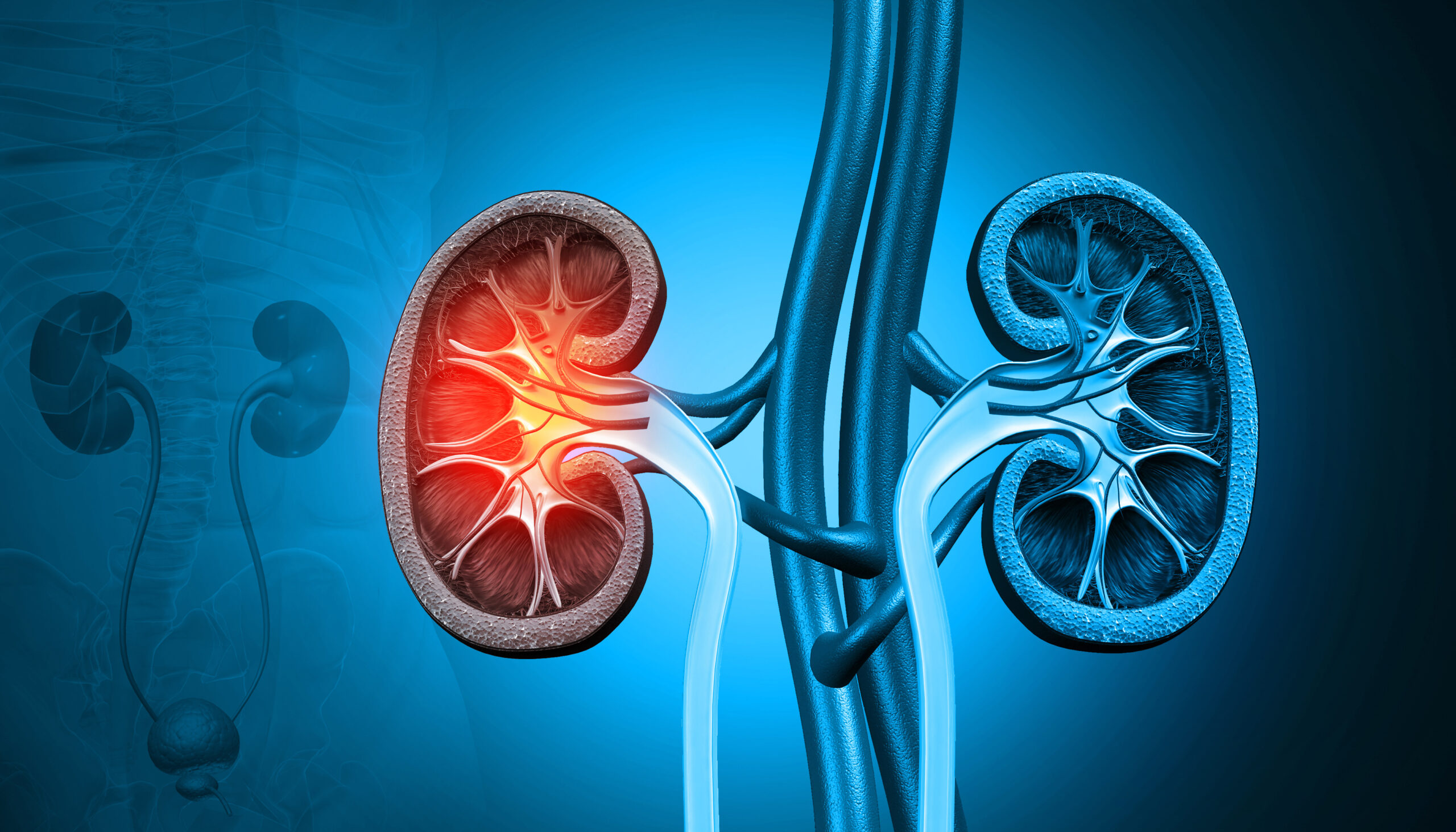 Acute kidney injury but long-term consequences!